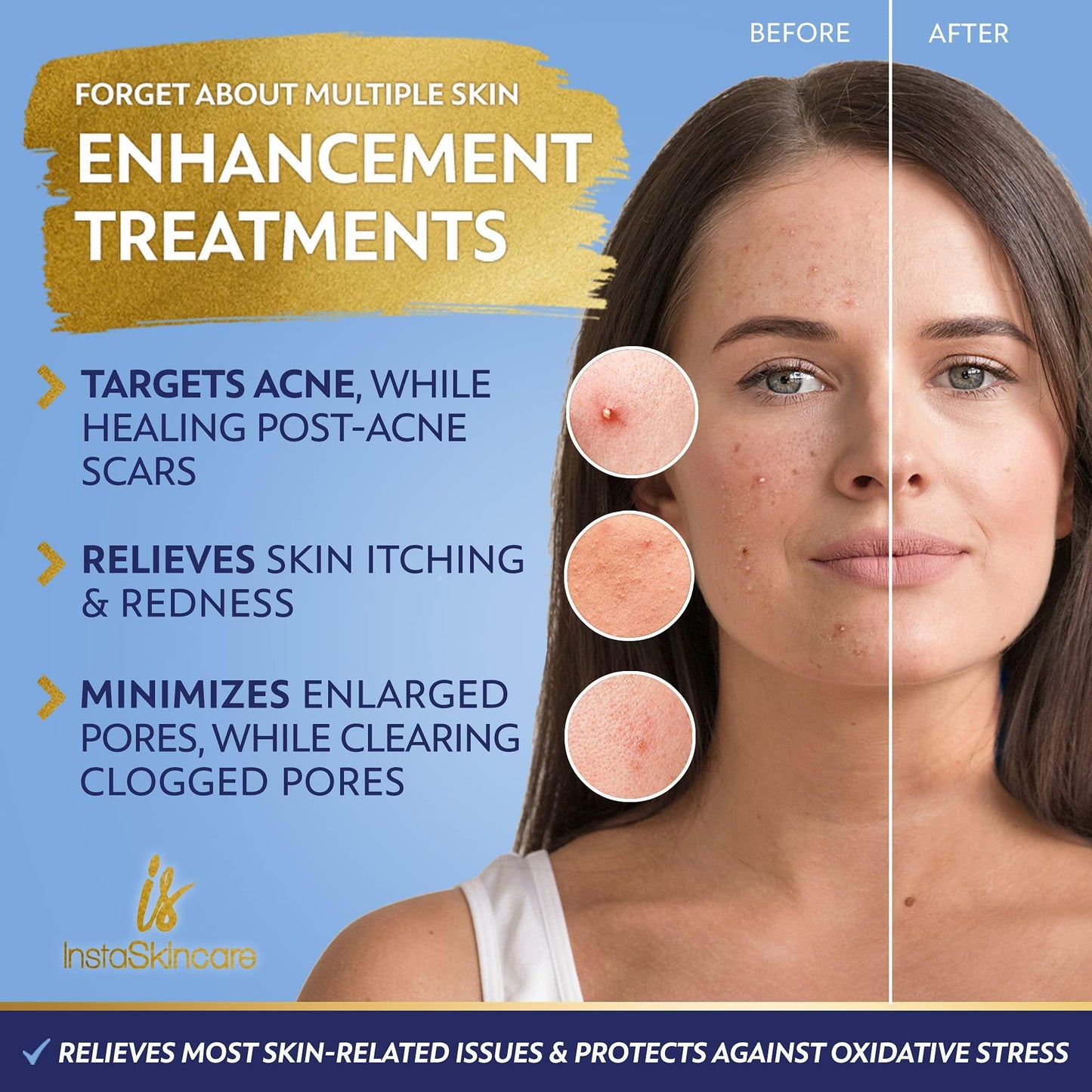 DOUBLE SIZED (2Oz) Niacinamide Serum for Face